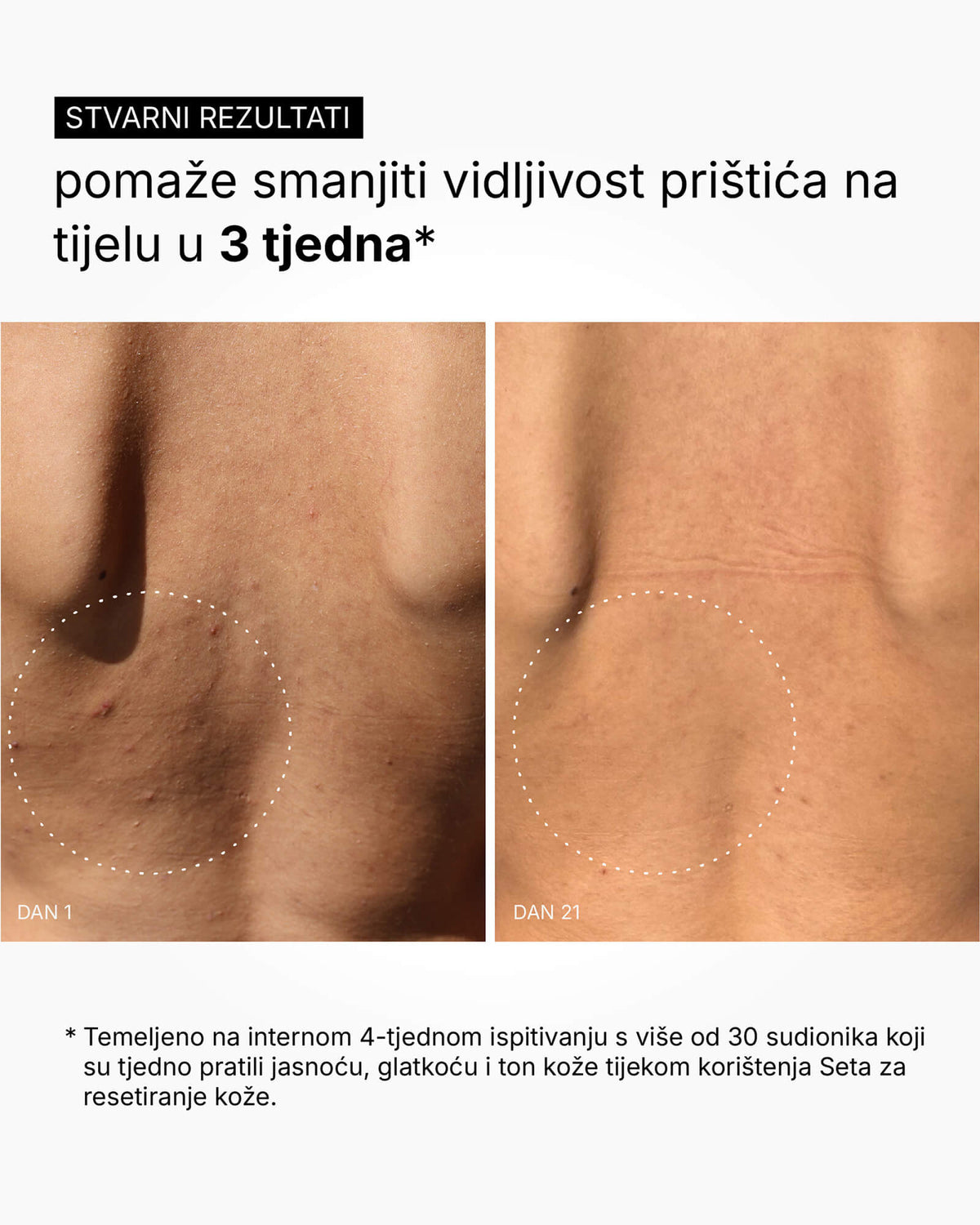 Skin Reset Set - Kompletná starostlivosť o telo