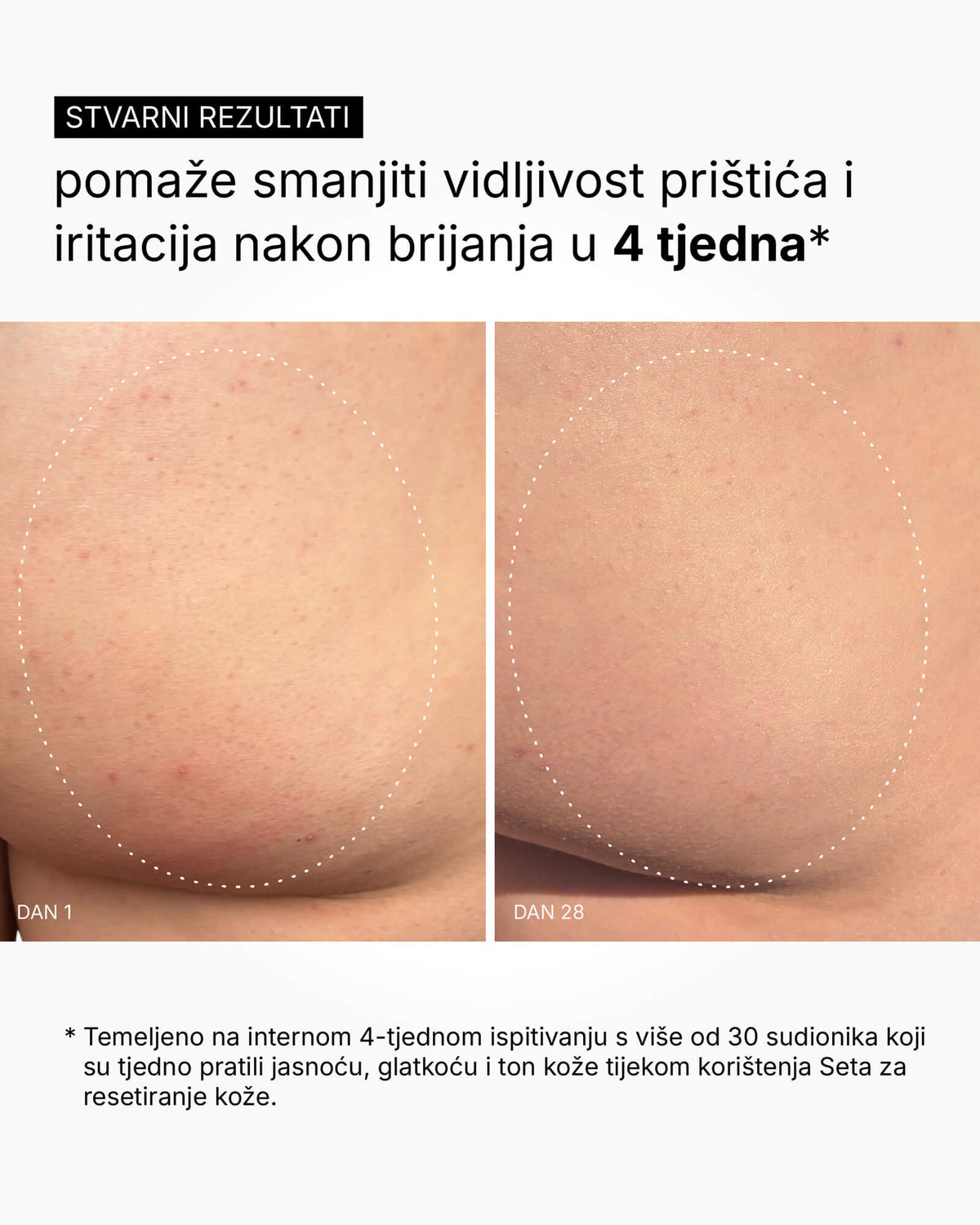 Skin Reset Set - Kompletná starostlivosť o telo