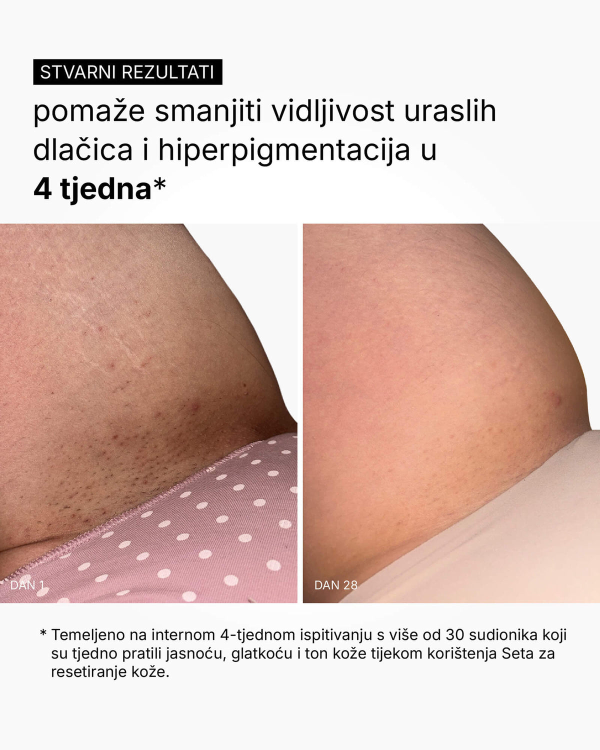 Skin Reset Set - Kompletná starostlivosť o telo
