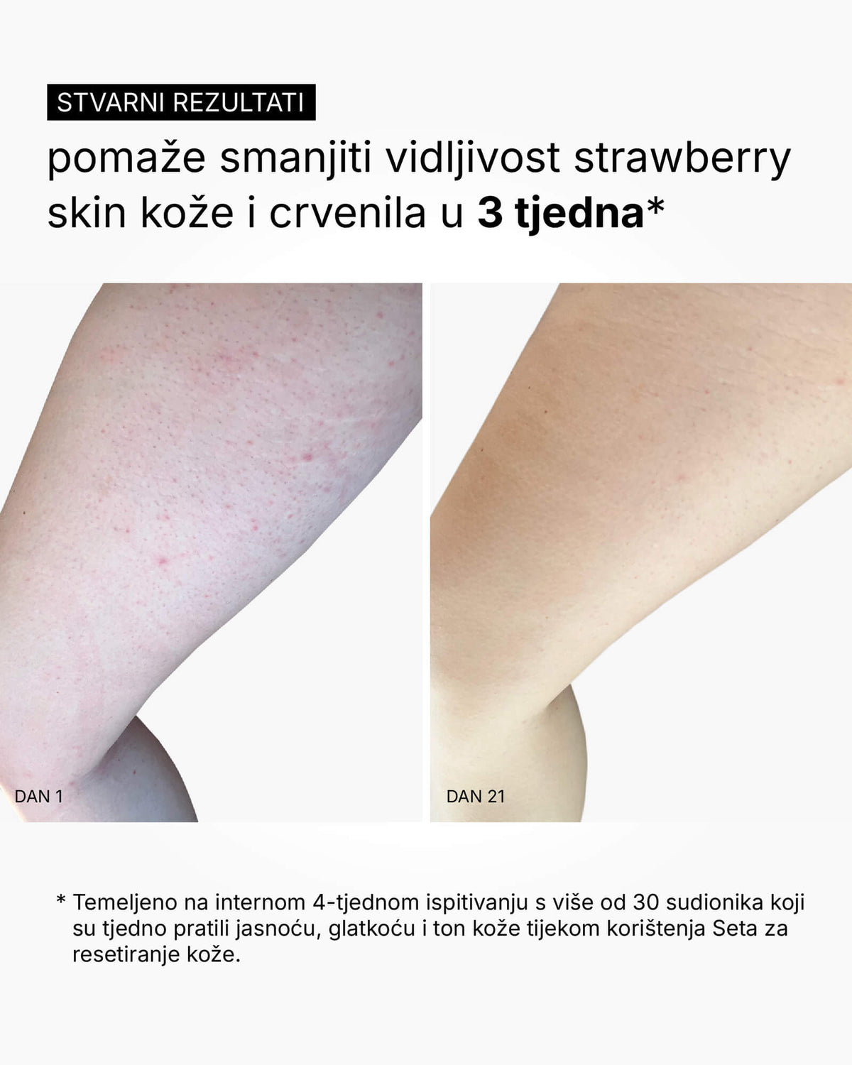 Skin Reset Set - Kompletná starostlivosť o telo