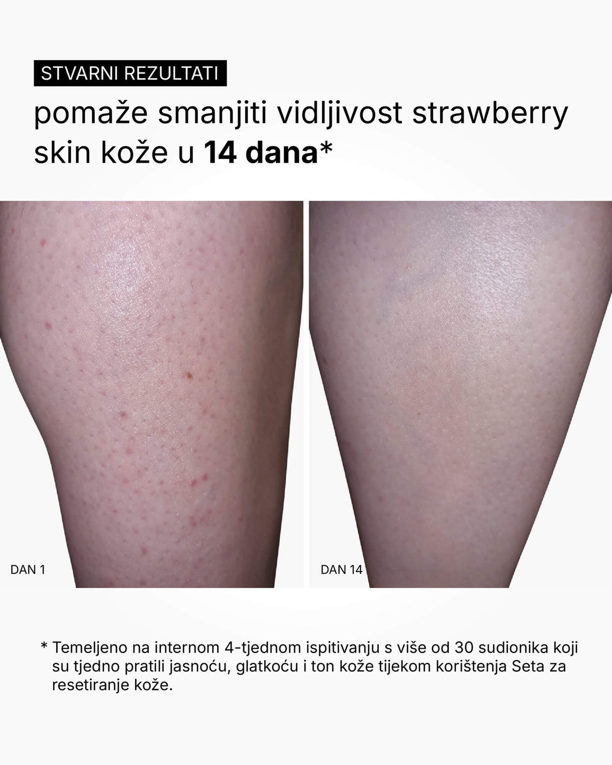 Skin Reset Set - Kompletná starostlivosť o telo