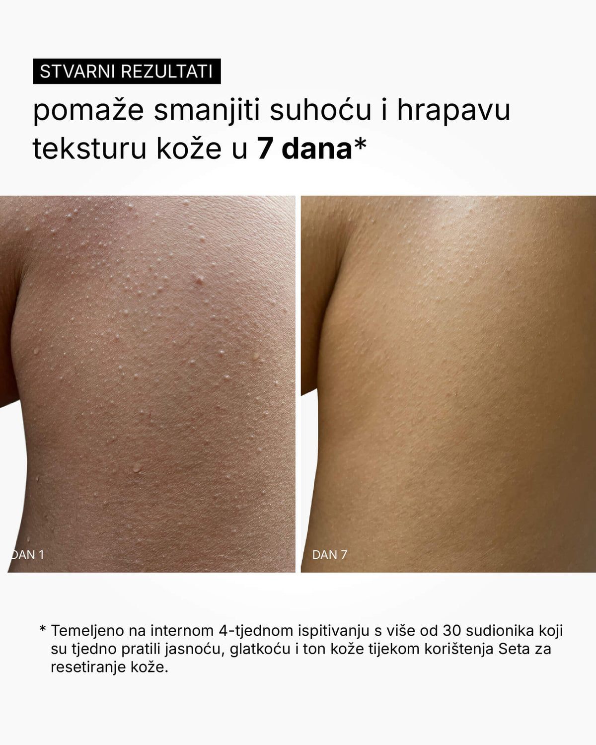 Skin Reset Set - Kompletná starostlivosť o telo
