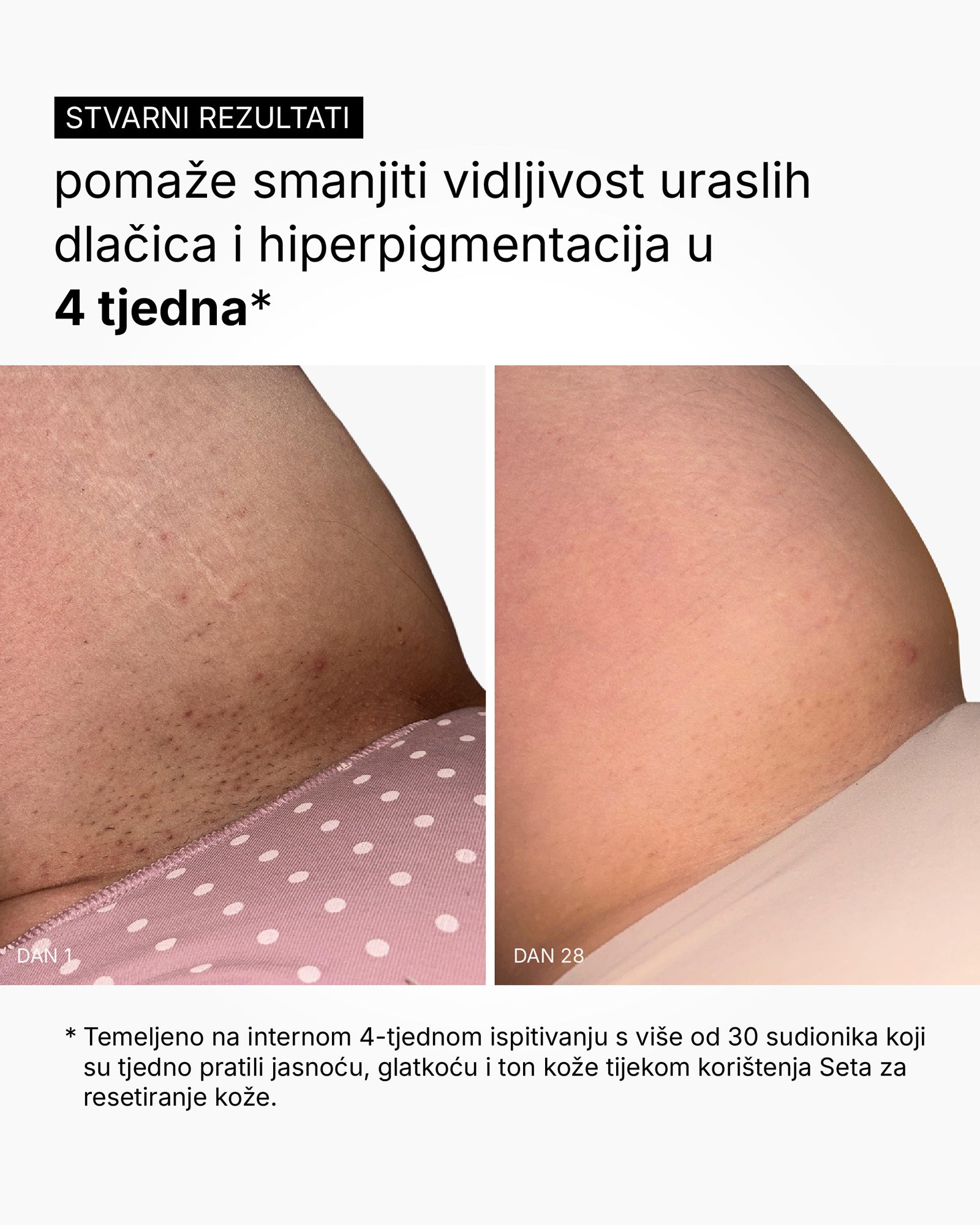 Skin Reset Set - Kompletná rutina pre telo
